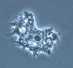 acanthamoeba