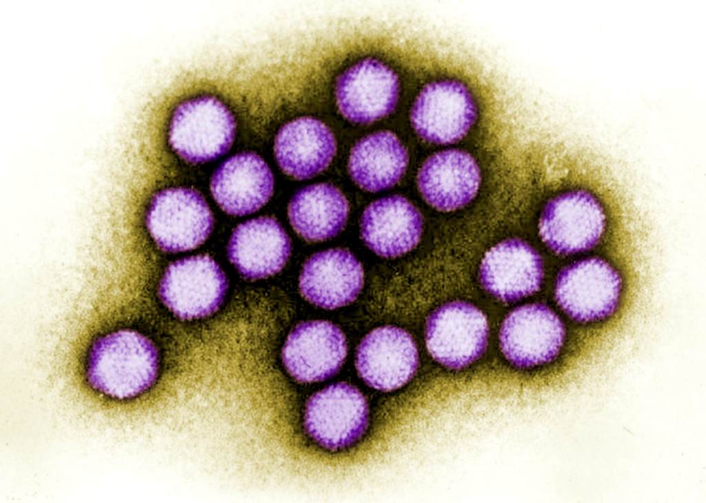 Imagen de microscopio de adenovirus coloreada para resaltar las cápsides en morado